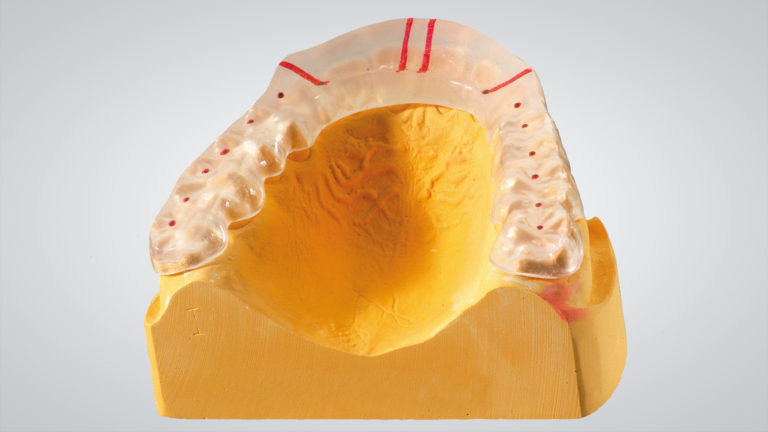 Ritterschlag für primosplint