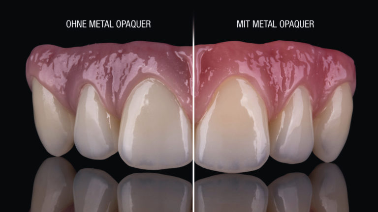 Metal Opaquer