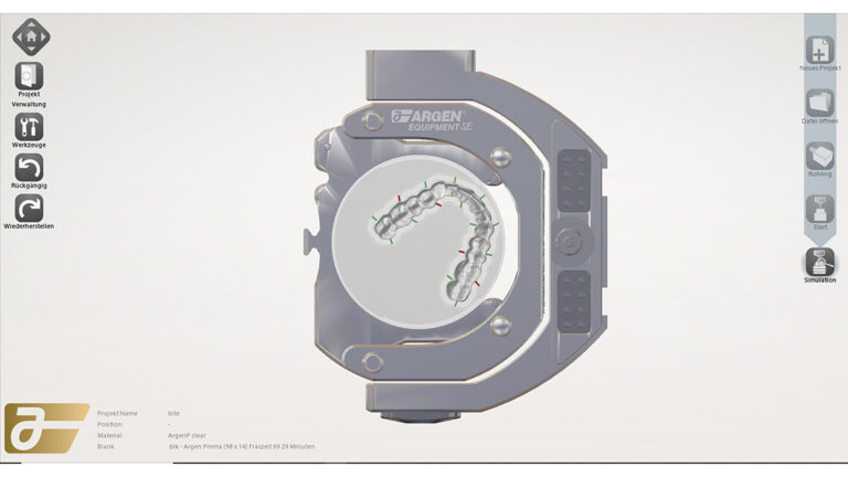 Individuell mit Argen Equipment