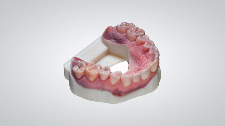Mehr Qualität und Ästhetik ­mit 3D-Druck