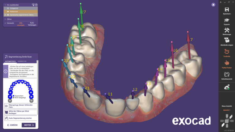 Einfach zum „Smile Makeover“