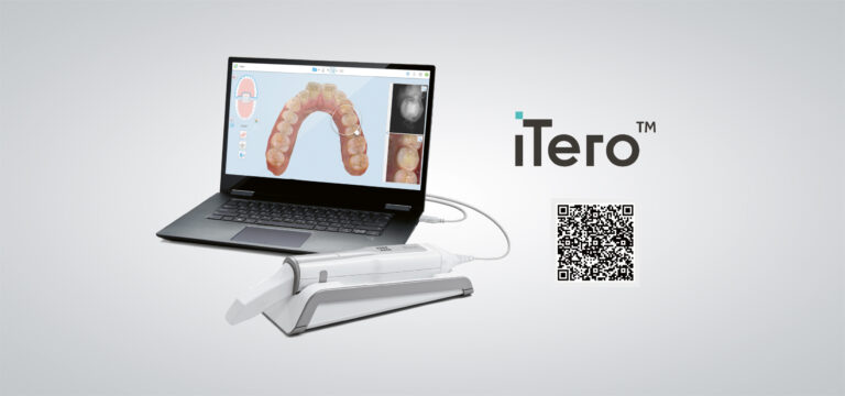 iTERO Intraoralscanner