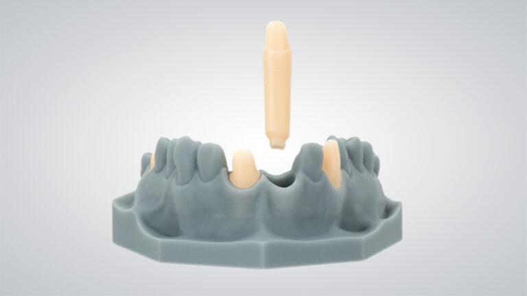 CAD/CAM-Parameter für den optimalen 3D-Druck ermitteln
