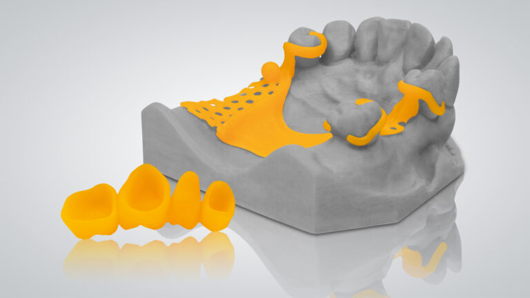 VarseoWax CAD/Cast