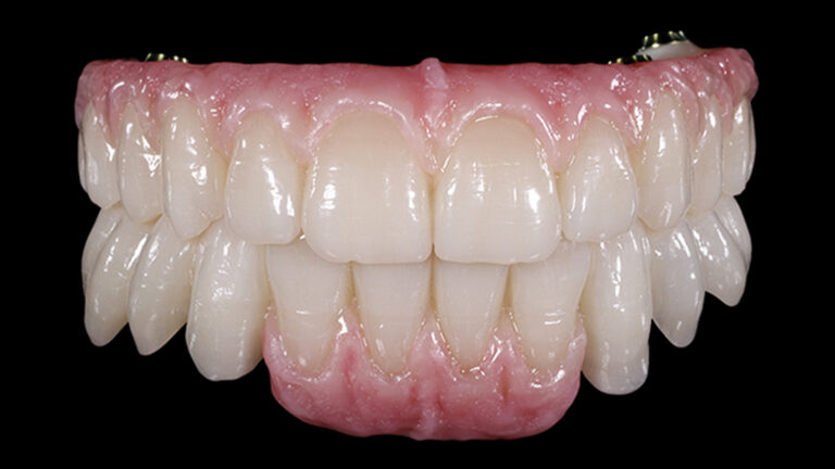 Multistratum Flexible