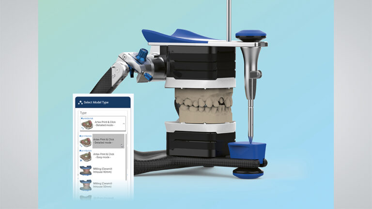 Artex Print&Click ist ein innovatives Artikulationssystem für 3D-gedruckte Modelle im Artex-Artikulator.