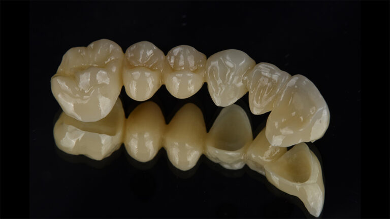 Cercon yo ML ist das neue Zirkonoxid von Dentsply Sirona, das für zahlreiche Restaurationen bis zum „All-on-X“-Konzept entwickelt wurde.